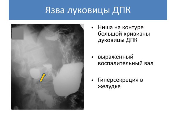 Кракен актуальная ссылка тор